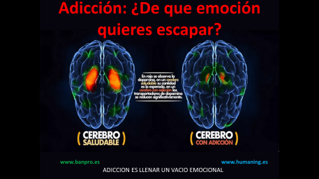 adiccion
